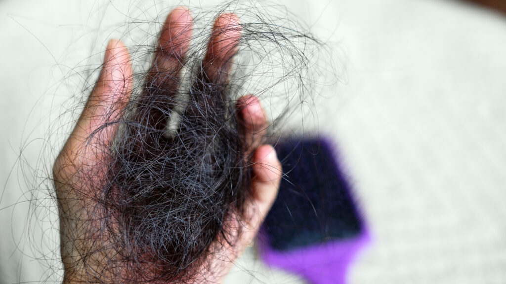 effective ways to prevent hair loss